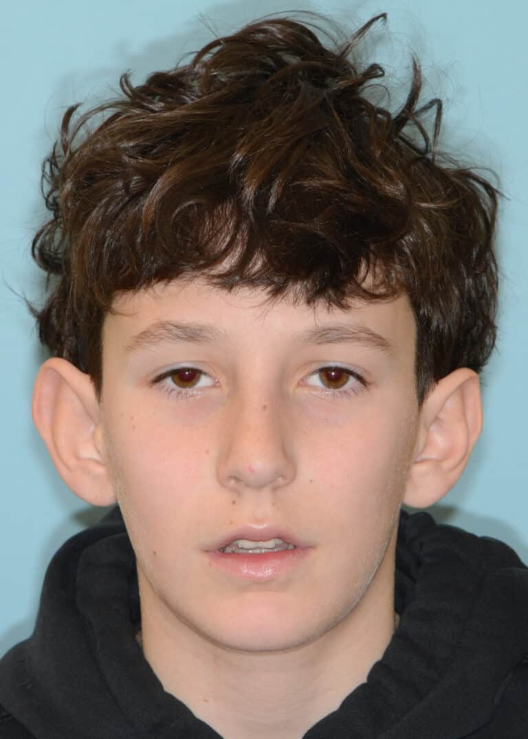 Before Image:  - front